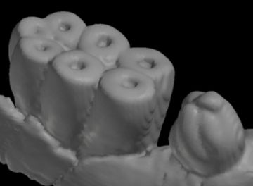 デスモスチルスの歯